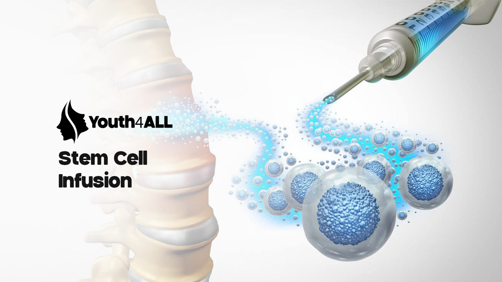 Stem cell infusion
